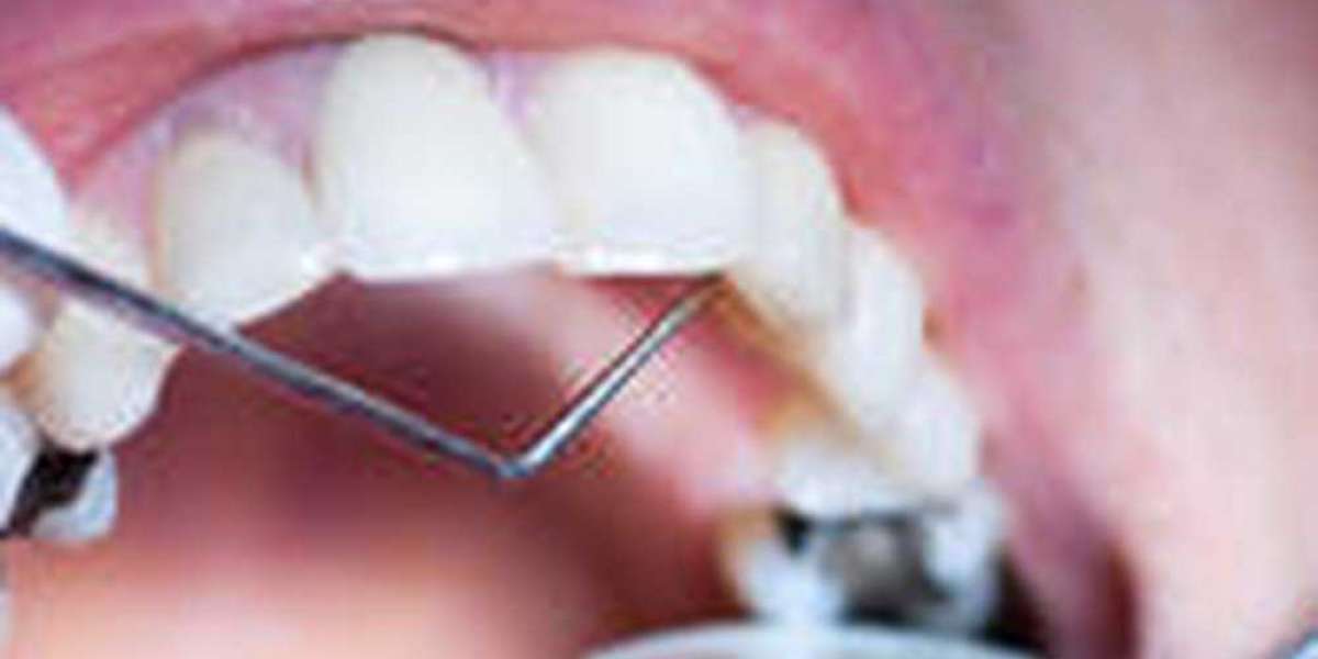MetroPlus Dentist Directory: Brooklyn's Finest Dental Professionals