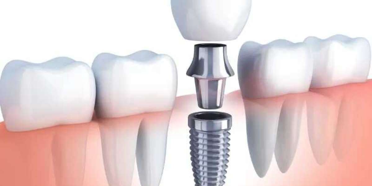 Understanding Oral Sedation Dentistry: Benefits, Risks, and Considerations