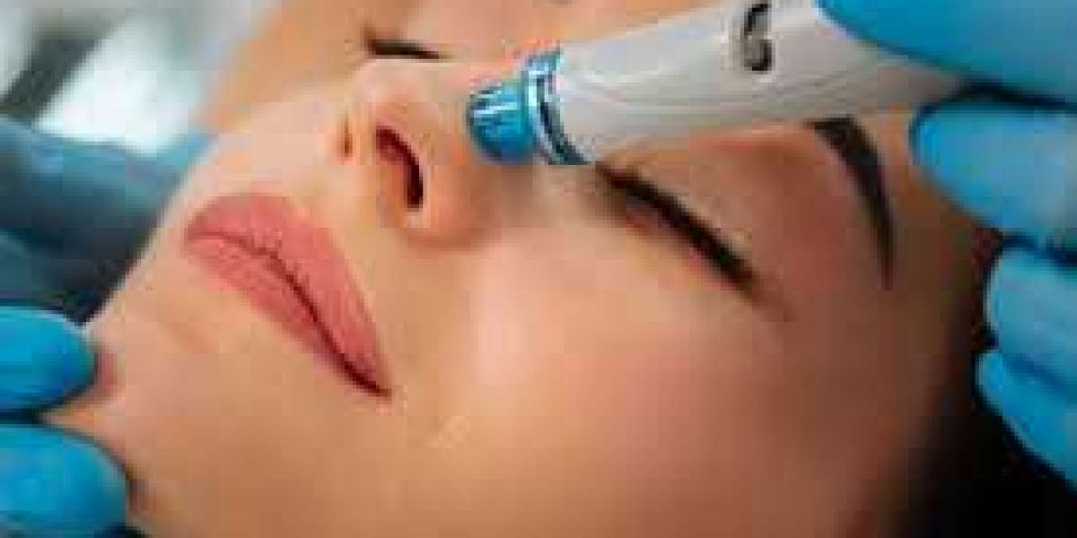 The Ultimate Guide to Hydrafacial Dublin: Benefits and What to Expec